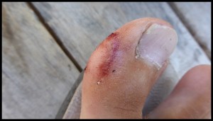 coupant les piquets Hilleberg. J'aurais du prendre la photo avant de refermer la plaie, c'était plus sympa